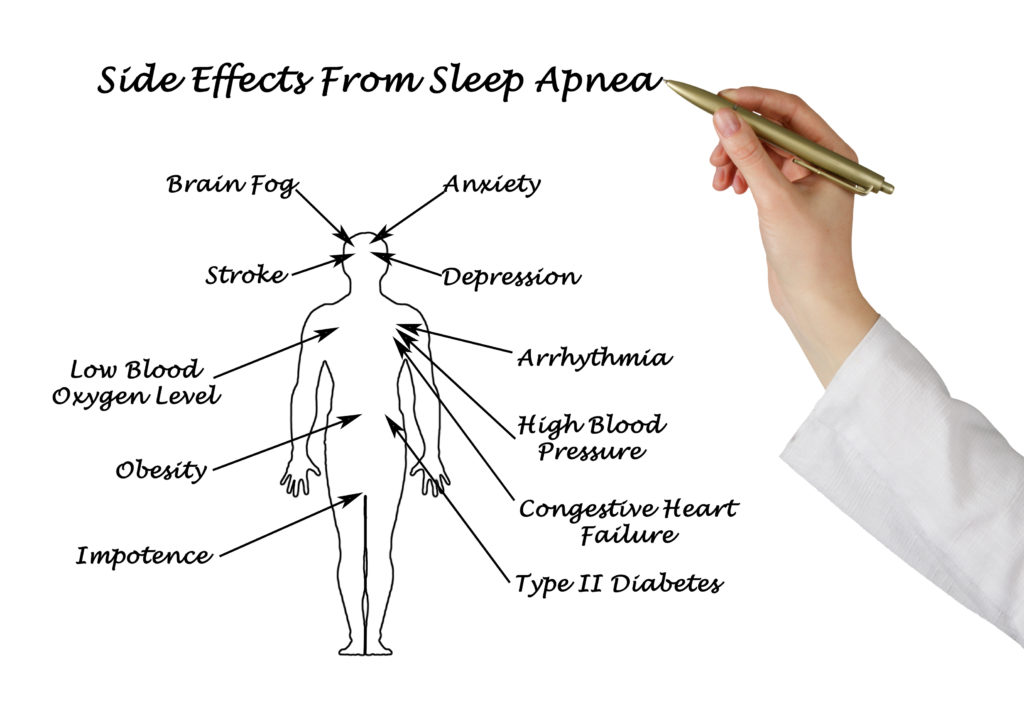 Sleep Diagram